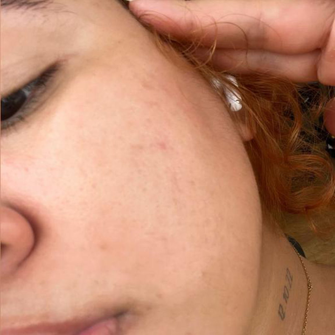 Antes